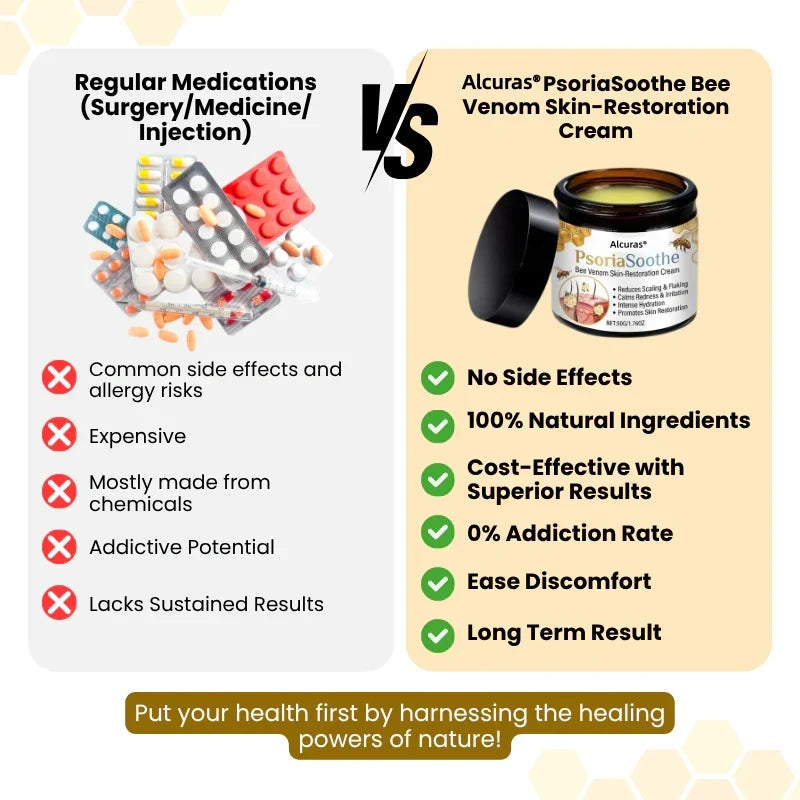 Alcuras® PsoriaSoothe Bee Venom Skin-Restoration Cream