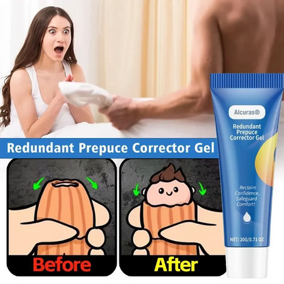 Alcuras® Gentle Foreskin Corrector Gel – Soothing, Natural Relief